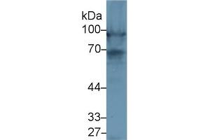 Detection of NEXN in Rat Heart lysate using Polyclonal Antibody to Nexilin (NEXN)