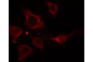 ABIN6274916 staining HepG2 cells by IF/ICC. (SLC27A5 antibody  (Internal Region))