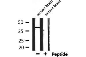 Western blot analysis of extracts from mouse brain, using TAS2R40 Antibody. (TAS2R40 antibody  (Internal Region))