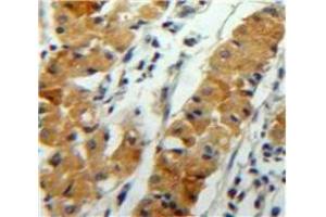 Used in DAB staining on fromalin fixed paraffin-embedded Stomach tissue (ANGPTL2 antibody  (AA 267-493))