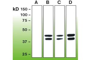 Western Blotting (WB) image for anti-Mitogen-Activated Protein Kinase 1/3 (MAPK1/3) (phosphospecific) antibody (ABIN870326) (ERK1/2 antibody  (phosphospecific))