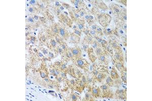 Immunohistochemistry of paraffin-embedded human liver using UBE2U antibody at dilution of 1:100 (40x lens).