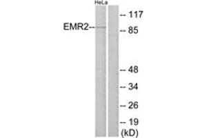 Western Blotting (WB) image for anti-Egf-Like Module Containing, Mucin-Like, Hormone Receptor-Like 2 (EMR2) (AA 121-170) antibody (ABIN2890819) (EMR2 antibody  (AA 121-170))