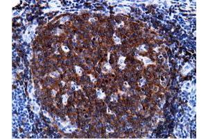 Immunohistochemical staining of paraffin-embedded Human Kidney tissue using anti-PIK3AP1 mouse monoclonal antibody.