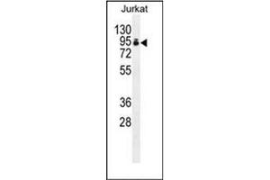 Western blot analysis of PAP Antibody (Center) in Jurkat cell line lysates (35ug/lane). (PAPOLA antibody  (Middle Region))