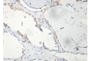 Immunohistochemical staining of formalin-fixed paraffin-embedded human thyroid showing membrane staining with FAM72A antibody at a dilution of 1/100. (FAM72A antibody  (AA 2-148))