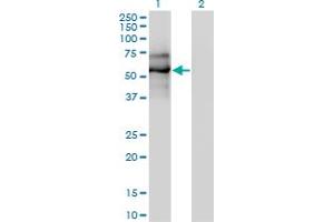 Western Blot analysis of EBF1 expression in transfected 293T cell line by EBF1 monoclonal antibody (M01), clone 1C12. (EBF1 antibody  (AA 1-591))