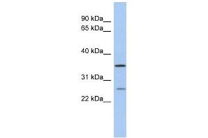 SDR-O antibody used at 1 ug/ml to detect target protein. (SDR9C7 antibody  (Middle Region))