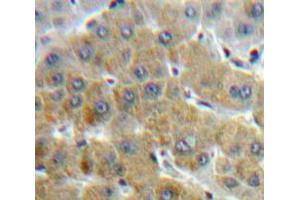 Used in DAB staining on fromalin fixed paraffin-embedded Liver tissue (SAA antibody  (AA 19-122))