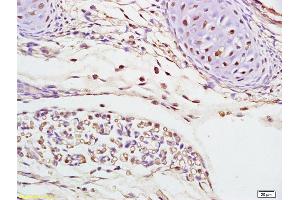 Formalin-fixed and paraffin embedded mouse embryo labeled with Rabbit Anti phospho-Cdc25B (Ser186) Polyclonal Antibody, Unconjugated (ABIN756967) at 1:200 followed by conjugation to the secondary antibody and DAB staining (CDC25B antibody  (pSer186))