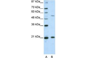 WB Suggested Anti-ZNF31 Antibody Titration:  2. (ZSCAN20 antibody  (N-Term))