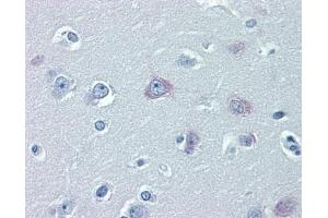 TRPM2 antibody was used for immunohistochemistry at a concentration of 4-8 ug/ml. (TRPM2 antibody  (N-Term))