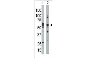 The anti-PRKR Pab (ABIN392779 and ABIN2837995) is used in Western blot to detect PRKR in mouse uterus tissue lysate (Lane 1) and HepG2 cell lysate (Lane 2). (EIF2AK2 antibody  (C-Term))