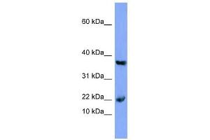 Myoglobin antibody used at 1 ug/ml to detect target protein. (Myoglobin antibody  (N-Term))