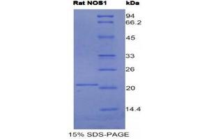 SDS-PAGE (SDS) image for Nitric Oxide Synthase 1, Neuronal (NOS1) (AA 468-616) protein (His tag) (ABIN1525538) (NOS1 Protein (AA 468-616) (His tag))