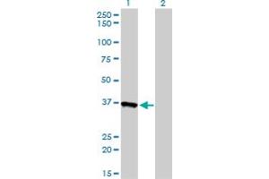 Western Blot analysis of AKR1A1 expression in transfected 293T cell line by AKR1A1 monoclonal antibody (M01), clone 1A11-2A4. (AKR1A1 antibody  (AA 1-325))