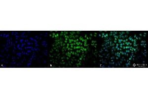 Immunocytochemistry/Immunofluorescence analysis using Rabbit Anti-TNF-R1 Polyclonal Antibody . (TNFRSF1A antibody  (AA 20-43) (PE))