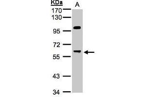 WB Image Sample(30 ug whole cell lysate) A:Hep G2 , 7. (PPP1R16A antibody  (Center))