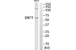 Western blot analysis of extracts from HepG2 cells, using DNTT antibody. (TdT antibody)