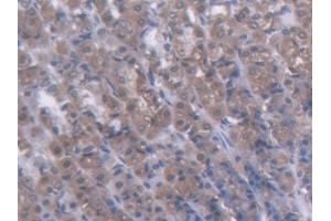 DAB staining on IHC-P; Samples: Rat Stomach Tissue (GCK antibody  (AA 194-410))