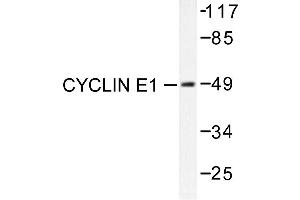 Image no. 1 for anti-Cyclin E1 (CCNE1) antibody (ABIN265380) (Cyclin E1 antibody)