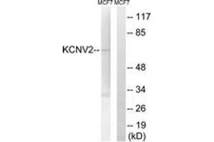 Western blot analysis of extracts from MCF-7 cells, using KCNV2 Antibody. (KCNV2 antibody  (AA 187-236))
