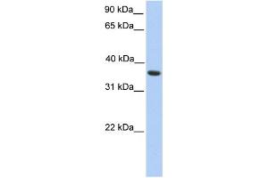 WB Suggested Anti-MAGEA4 Antibody Titration: 0. (MAGEA4 antibody  (C-Term))