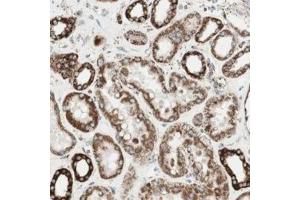 Immunohistochemical staining of human kidney with TOMM22 polyclonal antibody  shows strong cytoplasmic positivity in renal tubules at 1:200-1:500 dilution.