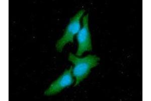 ICC/IF analysis of CSK in HeLa cells line, stained with DAPI (Blue) for nucleus staining and monoclonal anti-human CSK antibody (1:100) with goat anti-mouse IgG-Alexa fluor 488 conjugate (Green) (CSK antibody  (AA 1-450))
