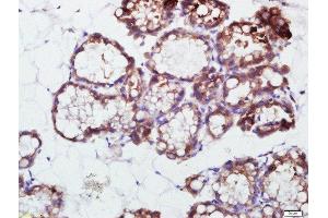 Paraformaldehyde-fixed, paraffin embedded rat mammary gland), Antigen retrieval by boiling in sodium citrate buffer (pH6) for 15min, Block endogenous peroxidase by 3% hydrogen peroxide for 30 minutes, Blocking buffer (normal goat serum) at 37°C for 20min, Antibody incubation with 	PRKCDBP Polyclonal Antibody, Unconjugated ( 	 ) at 1:500 overnight at 4°C, followed by a conjugated secondary and DAB staining. (PRKCDBP antibody  (AA 151-250))