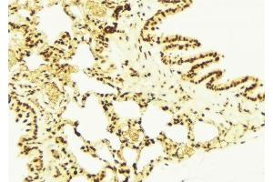 ABIN6277732 at 1/100 staining Mouse lung tissue by IHC-P. (NRF2 antibody  (pSer40))