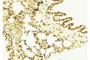 ABIN6277732 at 1/100 staining Mouse lung tissue by IHC-P.