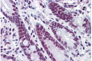 Human Small Intestine: Formalin-Fixed, Paraffin-Embedded (FFPE) (HDAC1 antibody  (AA 1-483))