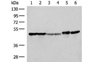 Western blot analysis of Hela A375 Human fetal liver tissue Human fetal brain tissue HepG2 cell and Mouse brain tissue lysates using FLOT2 Polyclonal Antibody at dilution of 1:350 (Flotillin 2 antibody)
