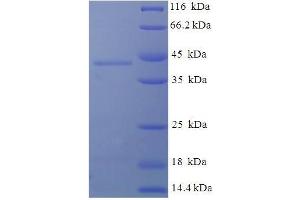 Deoxyguanosine Kinase Protein (DGUOK) (AA 40-277) (His-SUMO Tag)