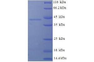 SDS-PAGE (SDS) image for Deoxyguanosine Kinase (DGUOK) (AA 40-277) protein (His-SUMO Tag) (ABIN4974632) (Deoxyguanosine Kinase Protein (DGUOK) (AA 40-277) (His-SUMO Tag))