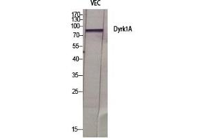 Western Blot analysis of various cells using Dyrk1A Polyclonal Antibody diluted at 1:500. (DYRK1A antibody  (AA 40-120))