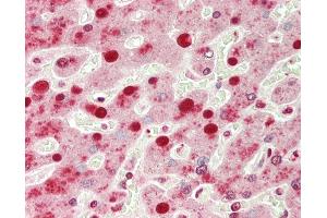 Human Liver: Formalin-Fixed, Paraffin-Embedded (FFPE)