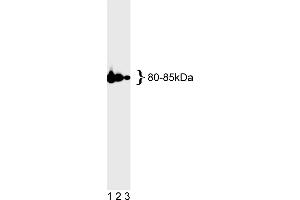 Western Blotting (WB) image for anti-MutL Homolog 1 (MLH1) antibody (ABIN967315) (MLH1 antibody)
