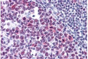 Immunohistochemistry (Formalin-fixed Paraffin-embedded Sections) (IHC (fp)) image for anti-High Mobility Group Box 1 (HMGB1) (AA 1-216) antibody (ABIN574266)