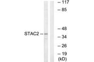 Western blot analysis of extracts from K562 cells, using STAC2 Antibody. (STAC2 antibody  (AA 211-260))