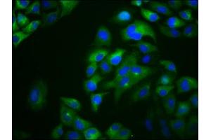 Immunofluorescence staining of Hela cells with ABIN7166575 at 1:133, counter-stained with DAPI. (Otopetrin 1 antibody  (AA 414-544))