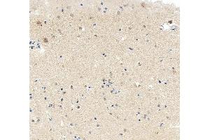 IHC analysis of MEF2C using anti-MEF2C antibody (ABIN6719606). (MEF2C antibody)
