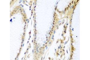 Immunohistochemistry of paraffin-embedded Human stomach using MYBBP1A Polyclonal Antibody at dilution of 1:100 (40x lens). (MYBBP1A antibody)