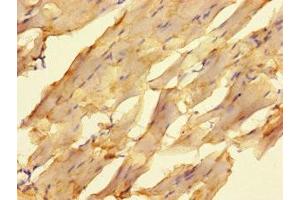 Immunohistochemistry of paraffin-embedded human skeletal muscle tissue using ABIN7176667 at dilution of 1:100
