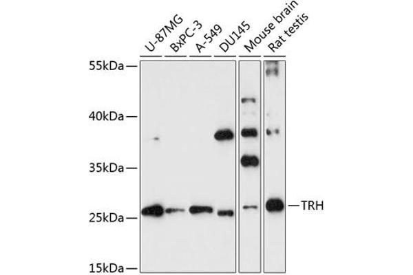 TRH antibody  (AA 100-200)