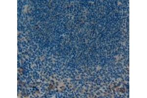 Used in DAB staining on fromalin fixed paraffin- embedded Kidney tissue (PTPRH antibody  (AA 685-909))
