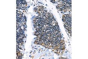 Immunohistochemistry of paraffin embedded rat thymus using Skar (ABIN7074970) at dilution of 1:900 (400x lens) (p46 antibody)