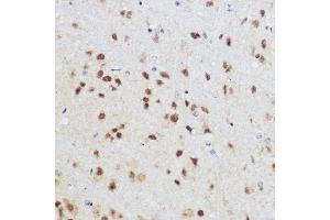 Immunohistochemistry of paraffin-embedded mouse brain using KLF12 antibody (ABIN7268152) at dilution of 1:100 (40x lens). (KLF12 antibody)