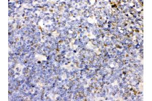 CD27 was detected in paraffin-embedded sections of human tonsil tissues using rabbit anti- CD27 Antigen Affinity purified polyclonal antibody (Catalog # ) at 1 µg/mL. (CD27 antibody  (AA 20-191))